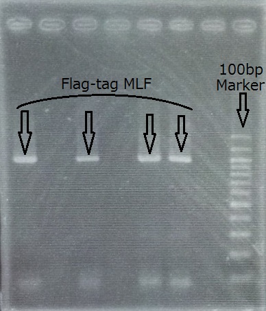 2011.09.14MLF-PCRチェック.JPG