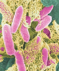 E-coli-in-color.jpg