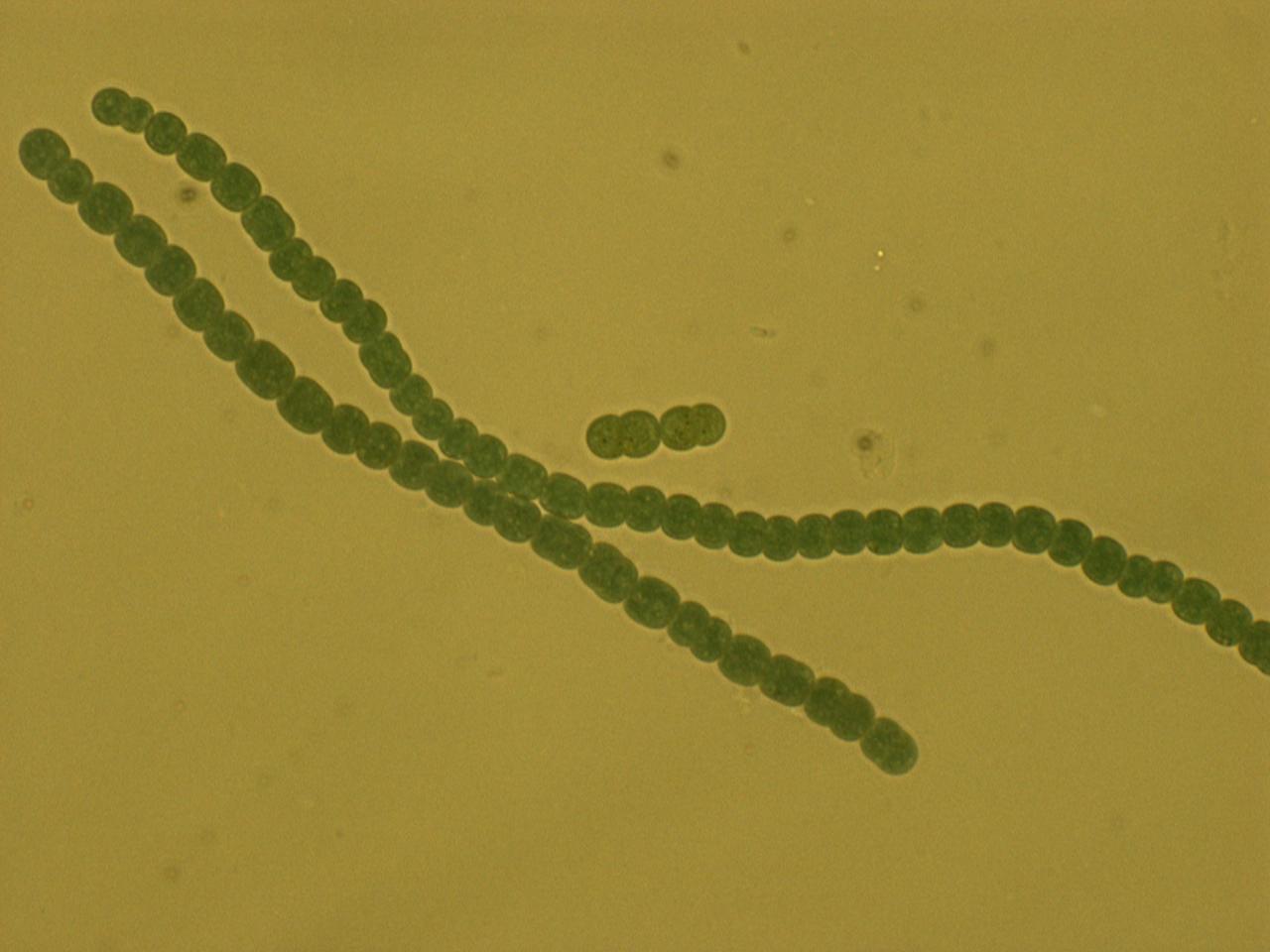 Anabaena 7120 is a filamentous bacterium capable of both photosynthesis and nitrogen fixation. Anabaena forms two cells types along the filament: vegetative cells, which perform photosynthesis, and heterocysts, which fix nitrogen. The nutrients are then shared up and down the chain. In this image, the heterocysts are the slightly larger oblong cells spaced about every eighth cell. Citation