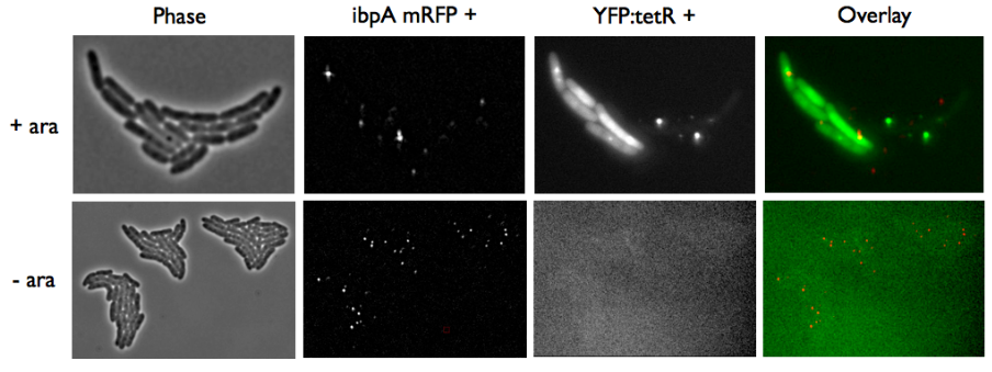 Microscopy yfp ibpa2.jpg