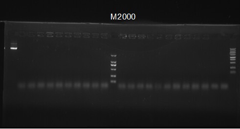 11SJTU07.24 positive test( bacteria).jpg
