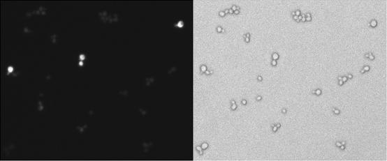 Left: Yeast cells fluorescing green. Right: Yeast cells visualized using normal DIC.