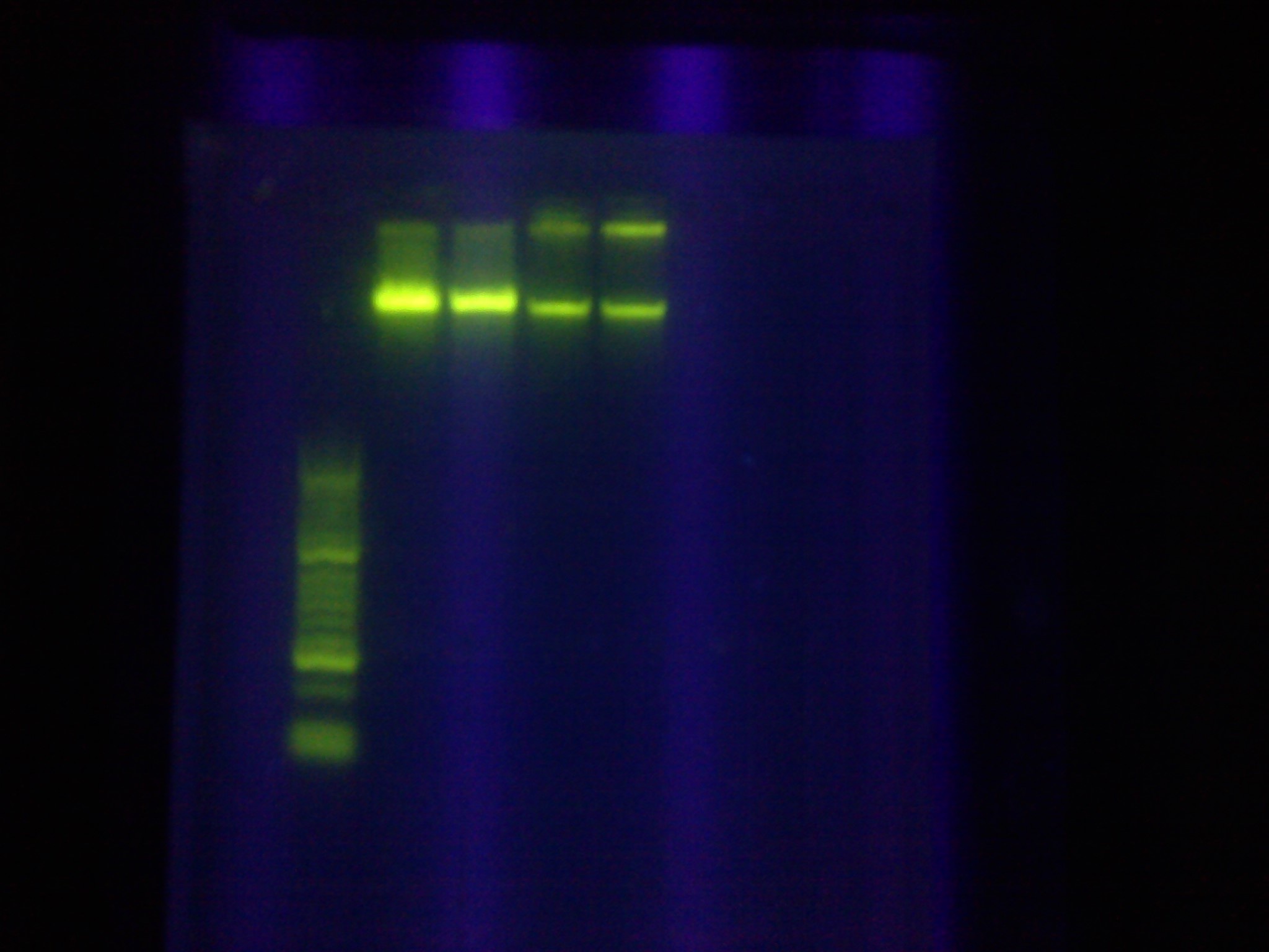 ASU 26 Genome Listeria.jpg