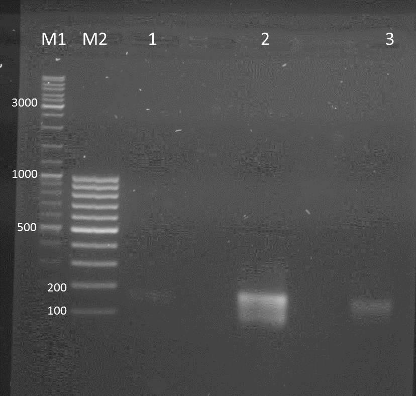 UP AG Restriction products of Lib-2 loop Insert PCR 2011-08-30.jpg